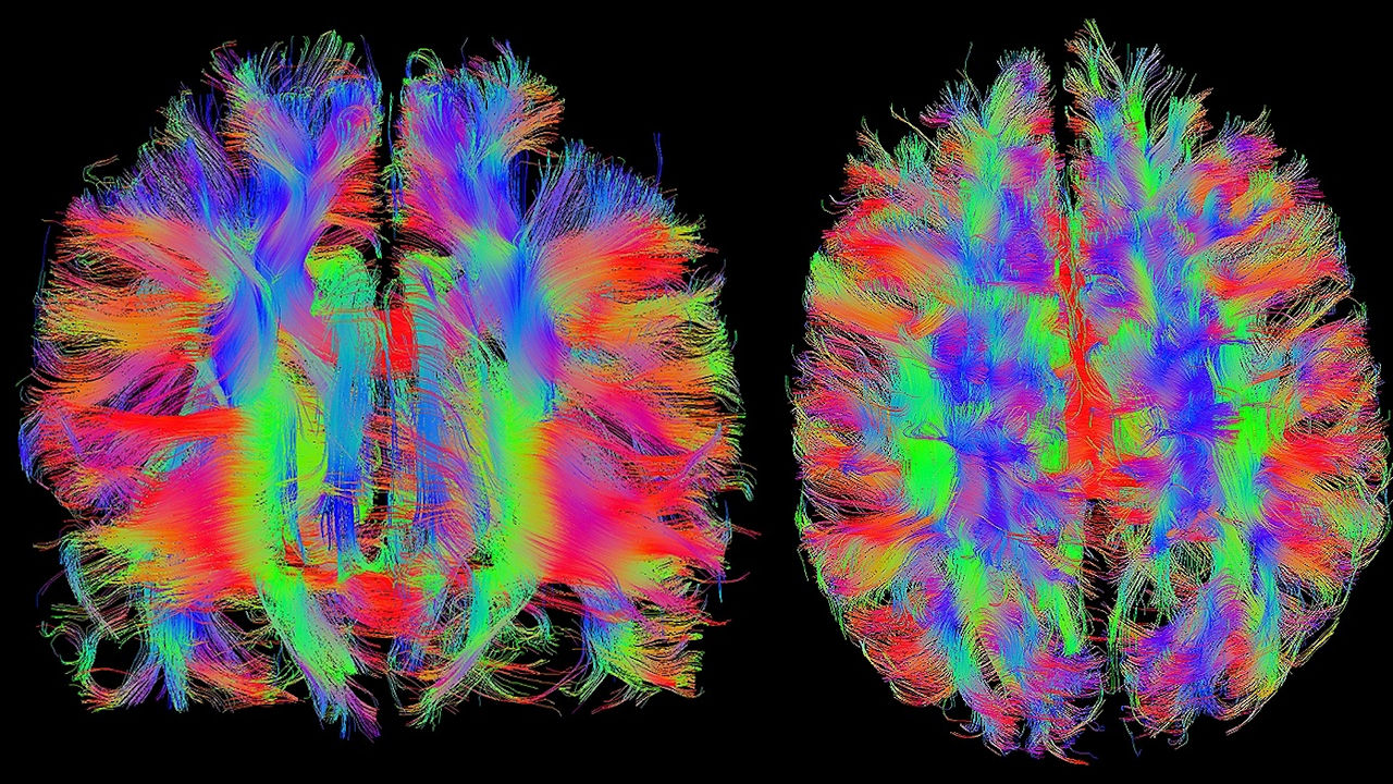 Zur Mathematik gehört auch der Umgang mit digitalen Bildern und um das Kennenlernen von Werkzeugen Bildanalyse. (Quelle: GR_Image/Pixabay)